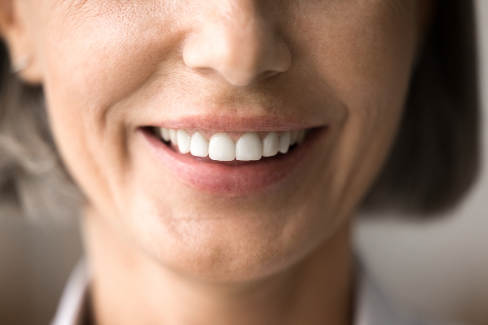 Smiles Makeovers Concord